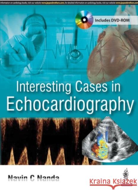 Interesting Cases in Echocardiography Navin C. Nanda 9789386056948