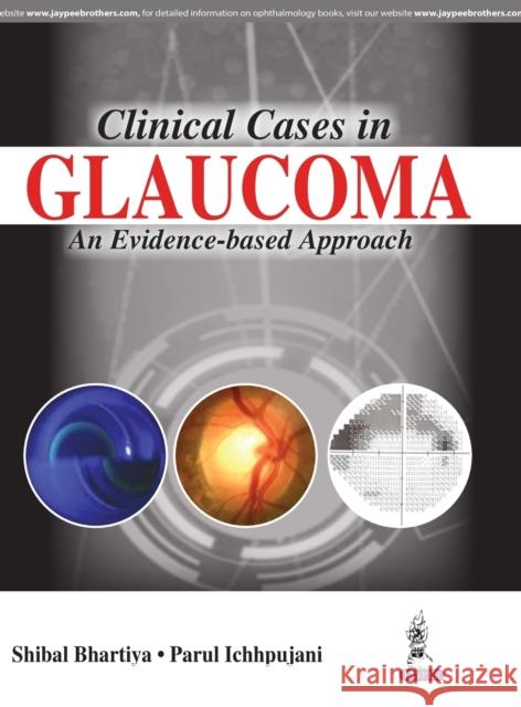 Clinical Cases in Glaucoma an Evidence-Based Approach Bhartiya, Shibal 9789386056962 Jaypee Brothers, Medical Publishers Pvt. Ltd.