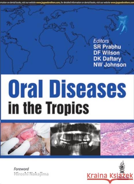 Oral Diseases in the Tropics S. R. Prabhu 9789386150554 Jaypee Brothers, Medical Publishers Pvt. Ltd.