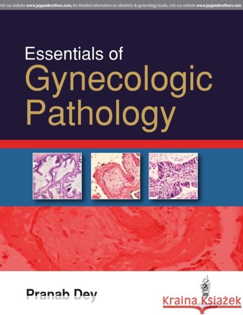 Essentials of Gynecologic Pathology Pranab Dey 9789386261205 Jaypee Brothers, Medical Publishers Pvt. Ltd.