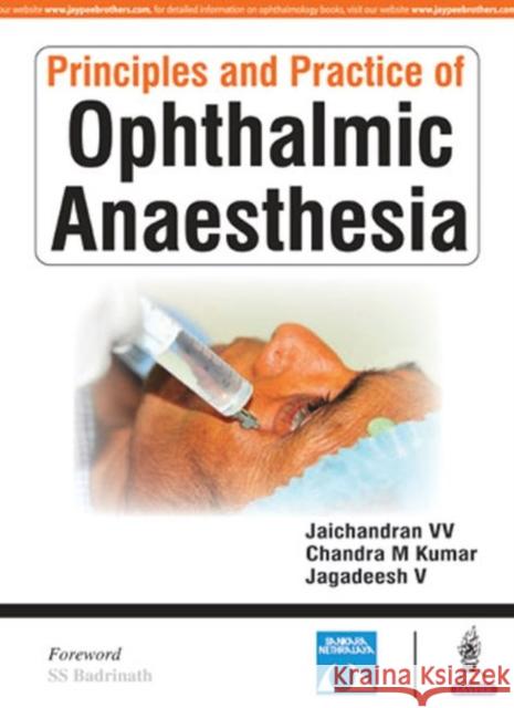 Principles and Practice of Ophthalmic Anaesthesia Jaichandran V V 9789386261236 Jaypee Brothers, Medical Publishers Pvt. Ltd.
