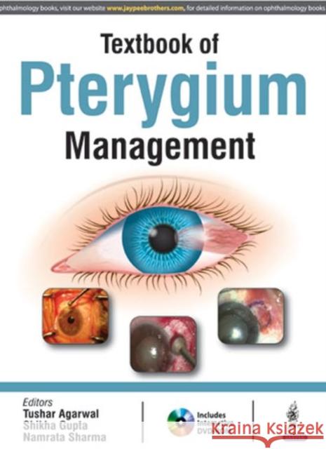 Textbook of Pterygium Management Tushar Agarwal 9789386261540 Jaypee Brothers, Medical Publishers Pvt. Ltd.