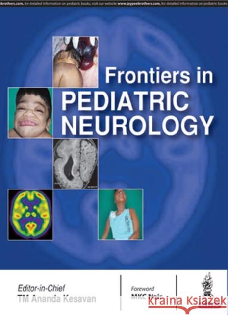 Frontiers in Pediatric Neurology TM Ananda Kesavan 9789386261755 Jaypee Brothers, Medical Publishers Pvt. Ltd.