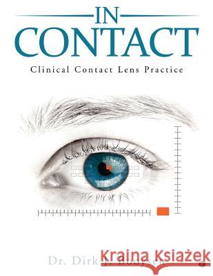 In Contact: Clinical Contact Lens Practice Dr Dirk J. Booysen 9789386295729 Notion Press
