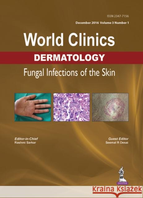 World Clinics Dermatology: Fungal Infections of the Skin: Volume 3, Number 1 Rashmi Sarkar 9789386322104