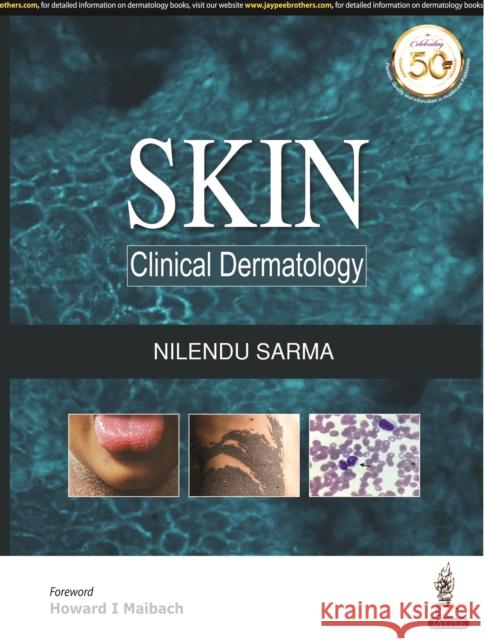Skin: Clinical Dermatology Nilendu Sarma 9789386322272 Jp Medical Ltd