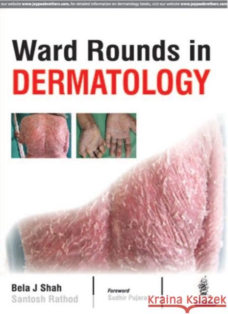 Ward Rounds in Dermatology Bela J. Shah 9789386322685 Jp Medical Ltd