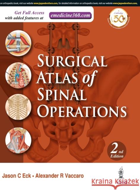 Surgical Atlas of Spinal Operations Jason Eck 9789386322708 Jp Medical Ltd