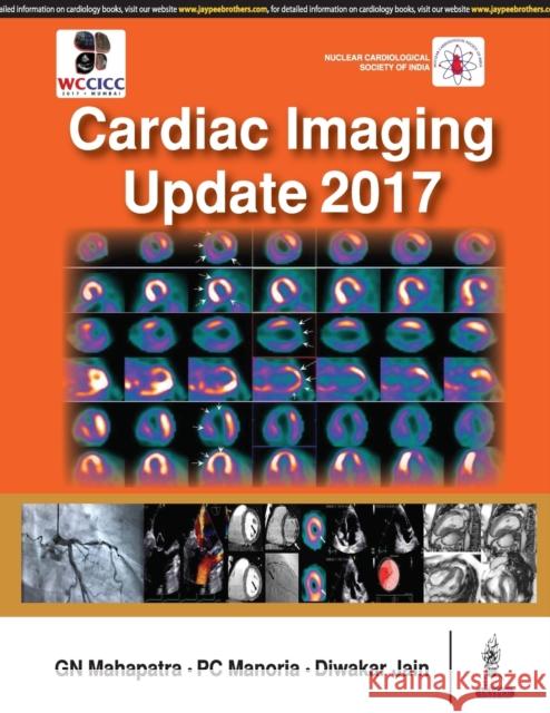 Cardiac Imaging Update 2017 Gn Mahapatra 9789386322937