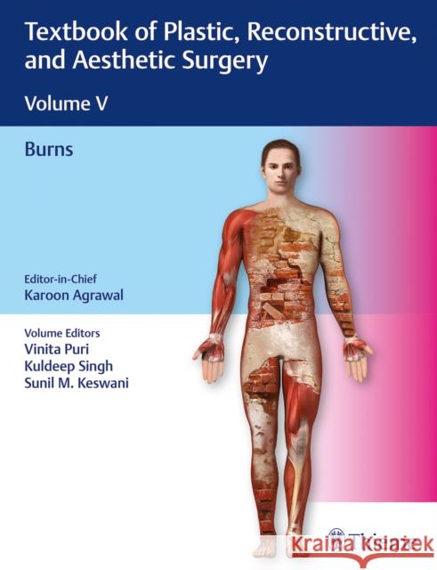 Textbook of Plastic, Reconstructive, and Aesthetic Surgery, Vol 5: Burns Agrawal, Karoon 9789388257855 Thieme, Stuttgart