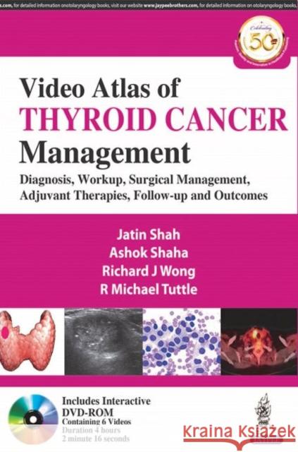 Video Atlas of Thyroid Cancer Management: Diagnosis, Workup, Surgical Management, Adjuvant Therapies, Follow-up and Outcomes Jatin Shah Ashok Shaha Richard J Wong 9789388958448 Jaypee Brothers Medical Publishers