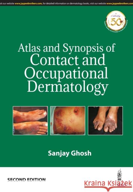 Atlas and Synopsis of Contact and Occupational Dermatology Sanjay Ghosh   9789388958615