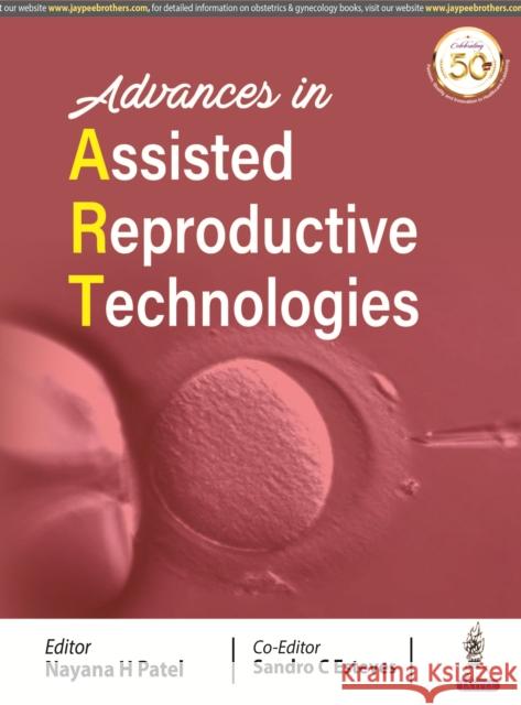 Advances in Assisted Reproductive Technologies H Nayana Patel C Sandro Esteves  9789388958998 Jaypee Brothers Medical Publishers