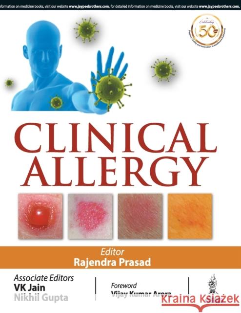 Clinical Allergy Rajendra Prasad, K V Jain, Nikhil Gupta 9789389129045