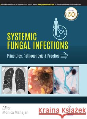 Systemic Fungal Infections Mahajan, Monica 9789389188349 Jaypee Brothers Medical Publishers