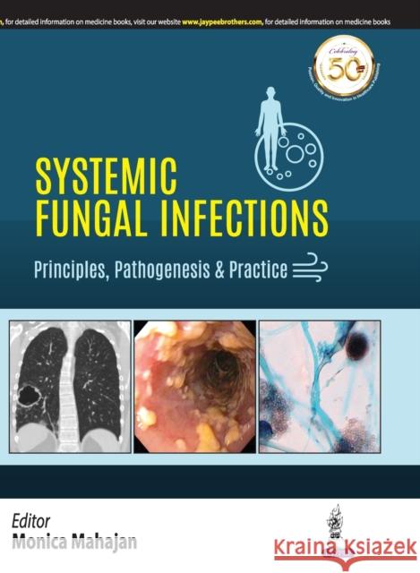 Systemic Fungal Infections Mahajan, Monica 9789389188349 Jaypee Brothers Medical Publishers