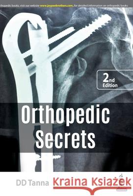 Orthopaedic Secrets D D Tanna   9789389188448 Jaypee Brothers Medical Publishers