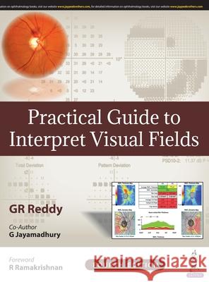 Practical Guide to Interpret Visual Fields GR Reddy   9789389587012 Jaypee Brothers Medical Publishers