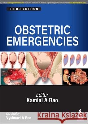 Obstetric Emergencies Kamini A Rao Vyshnavi A Rao  9789389587197 Jaypee Brothers Medical Publishers
