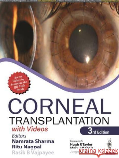 Corneal Transplantation: with Videos Namrata Sharma, Rasik B Vajpayee, Ritu Nagpal 9789389587227