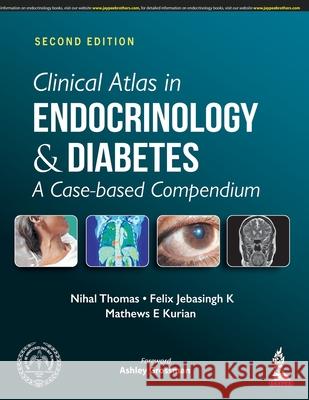 Clinical Atlas in Endocrinology and Diabetes: A Case-based Compendium Nihal Thomas Felix Jebasingh K Mathews E Kurian 9789389587302