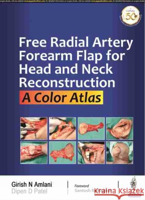 Free Radial Artery Forearm Flap in Head and Neck Reconstruction Girish N Amlani Dipen D Patel  9789389776775 Jaypee Brothers Medical Publishers
