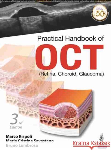 Practical Handbook of OCT: (Retina, Choroid, Glaucoma) Marco Rispoli Maria Cristina Savastano Bruno Lumbroso 9789390281350