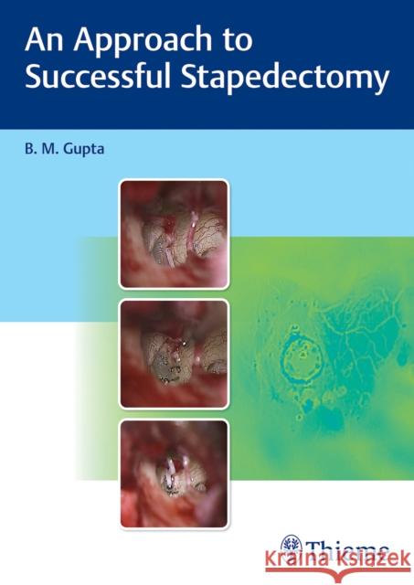 An Approach to Successful Stapedectomy Gupta, B 9789390553105 Thieme, Stuttgart