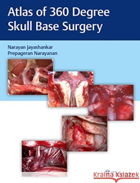 Atlas of 360 Degree Skull Base Surgery  9789390553136 Thieme, Stuttgart