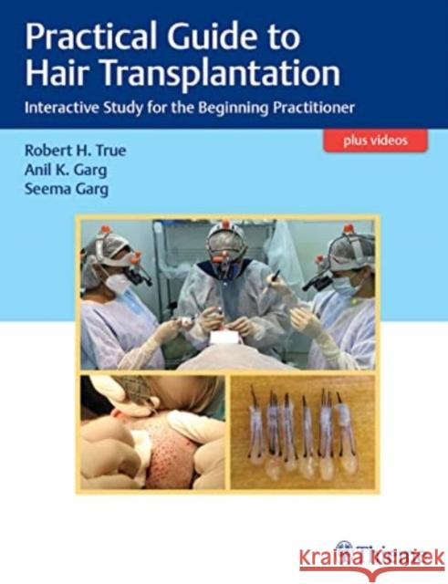 Practical Guide to Hair Transplantation: Interactive Study for the Beginning Practitioner True, Robert 9789390553242
