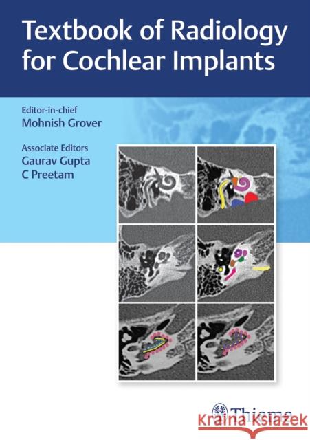 Textbook of Radiology for Cochlear Implants  9789392819261 Thieme Publishers Delhi