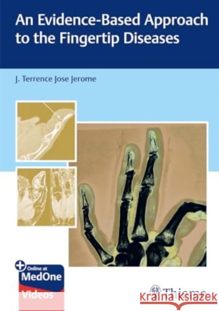 An Evidence-Based Approach to the Fingertip Diseases  9789392819360 Thieme Publishers Delhi
