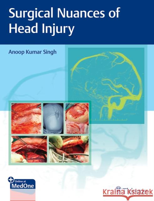 Surgical Nuances of Head Injury  9789395390248 Thieme Publishers Delhi