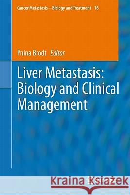 Liver Metastasis: Biology and Clinical Management Pnina Brodt 9789400702912 Not Avail