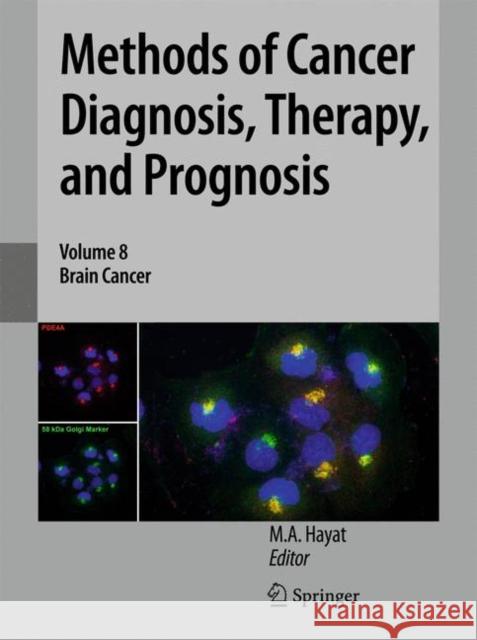 Methods of Cancer Diagnosis, Therapy, and Prognosis: Brain Cancer Hayat, M. A. 9789400733572 Springer