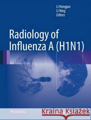 Radiology of Influenza a (H1n1) Li, Hongjun 9789400761612 Springer