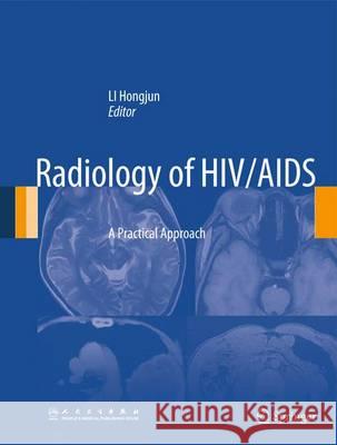 Radiology of Hiv/AIDS: A Practical Approach Li, Hongjun 9789400778221 Springer