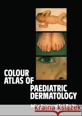 Colour Atlas of Paediatric Dermatology J. Verbov W. N. Morley 9789400973398 Springer