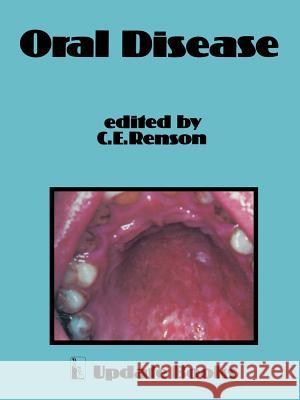 Oral Disease C. E. Renson 9789400987715 Springer