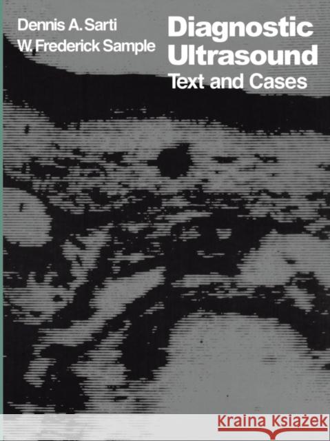 Diagnostic Ultrasound: Text and Cases Sarti, D. a. 9789400988132 Springer