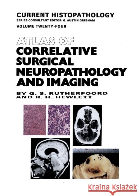 Atlas of Correlative Surgical Neuropathology and Imaging G.S. Rutherfoord, R.H. Hewlett 9789401046282 Springer