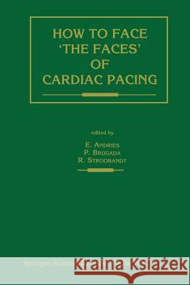 How to Face 'The Faces' of Cardiac Pacing Andries, Erik 9789401051392 Springer