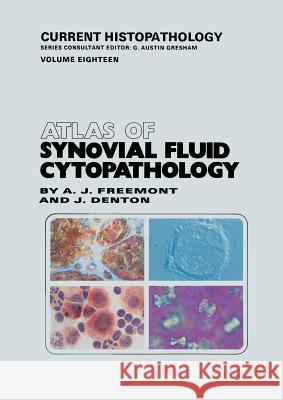 Atlas of Synovial Fluid Cytopathology Anthony J. Freemont Jayne Denton 9789401057028 Springer