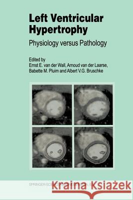 Left Ventricular Hypertrophy: Physiology versus Pathology Ernst E. van der Wall, A. van der Laarse, Babette M. Pluim, A.V. Bruschke 9789401058551