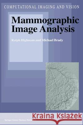 Mammographic Image Analysis R. Highnam, J.M. Brady 9789401059497 Springer