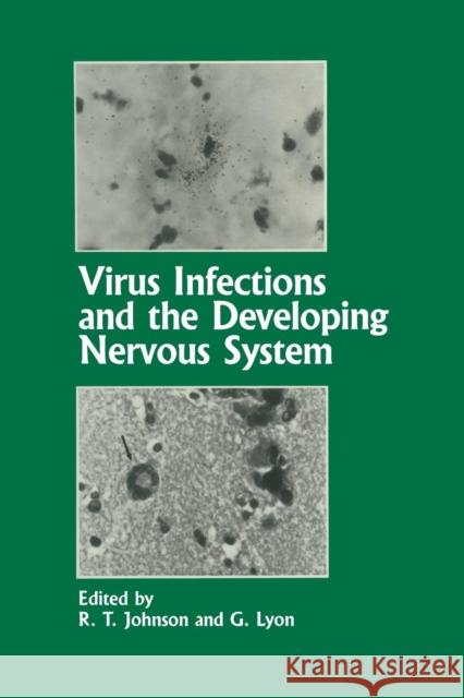 Virus Infections and the Developing Nervous System R. T. Johnson G. Lyon 9789401070515 Springer