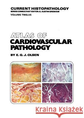 Atlas of Cardiovascular Pathology E. G. Olsen 9789401079402 Springer