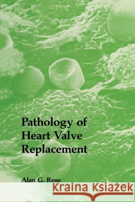 Pathology of Heart Valve Replacement Alan G. Rose   9789401079488 Springer