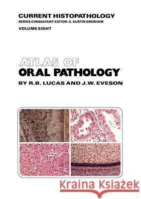 Atlas of Oral Pathology R. B. Lucas J. W. Eveson 9789401089593 Springer