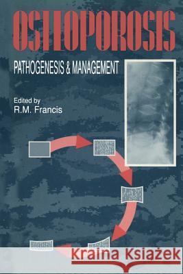 Osteoporosis: Pathogenesis and Management Francis, R. M. 9789401095822 Springer